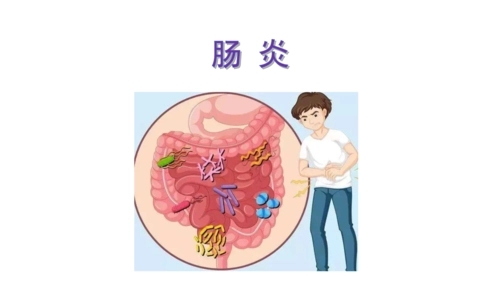 肠炎的主要症状有哪些 肠炎有哪些治疗要点