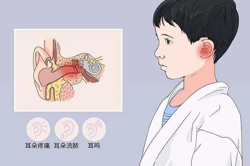 中耳炎偏方有哪些 怎么判断宝宝中耳炎